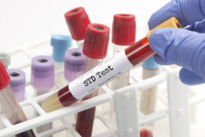 STD should you do a Test?